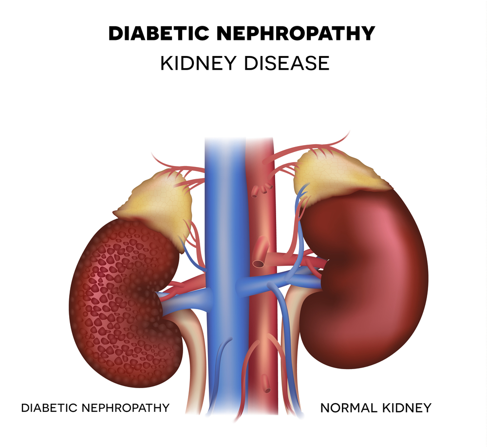 diabetic neuropathy treatment in nerul, kharghar, navi mumbai